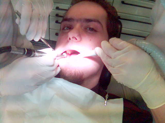 Bitte weit aufmachen. arzt bohren bohrer handschuhe mund sarlac schlauch zahn zahnarzt z�hne 