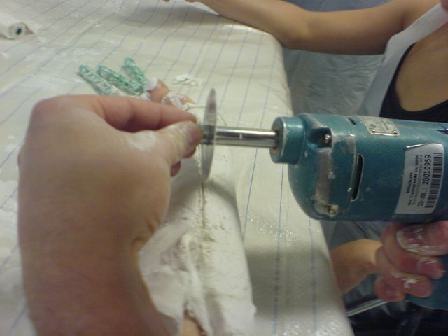 Bloss nicht zu tief!!!! gipss�ge s�ge uni kurs gips orthop�die blockpraktikum 