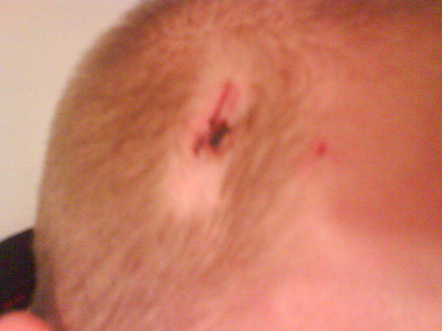 loch im kopp arschl�cher asis fussballfans koelnarena prolls kopf loch idioten hass 